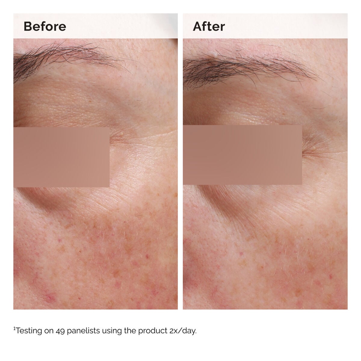 5% Face and Body Emulsion - Smooth Finish