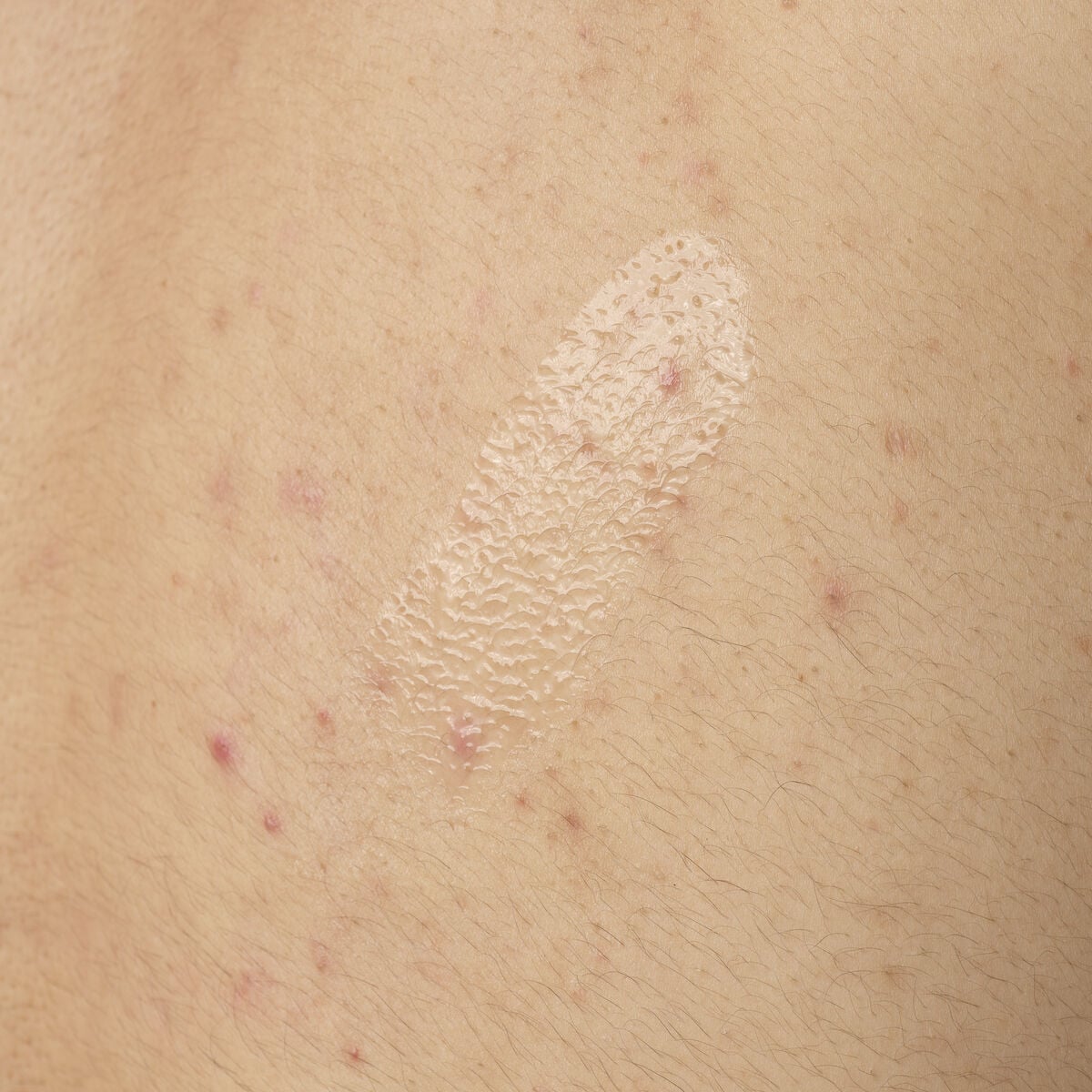 Acid 0.5% Body Serum - Modern Glow