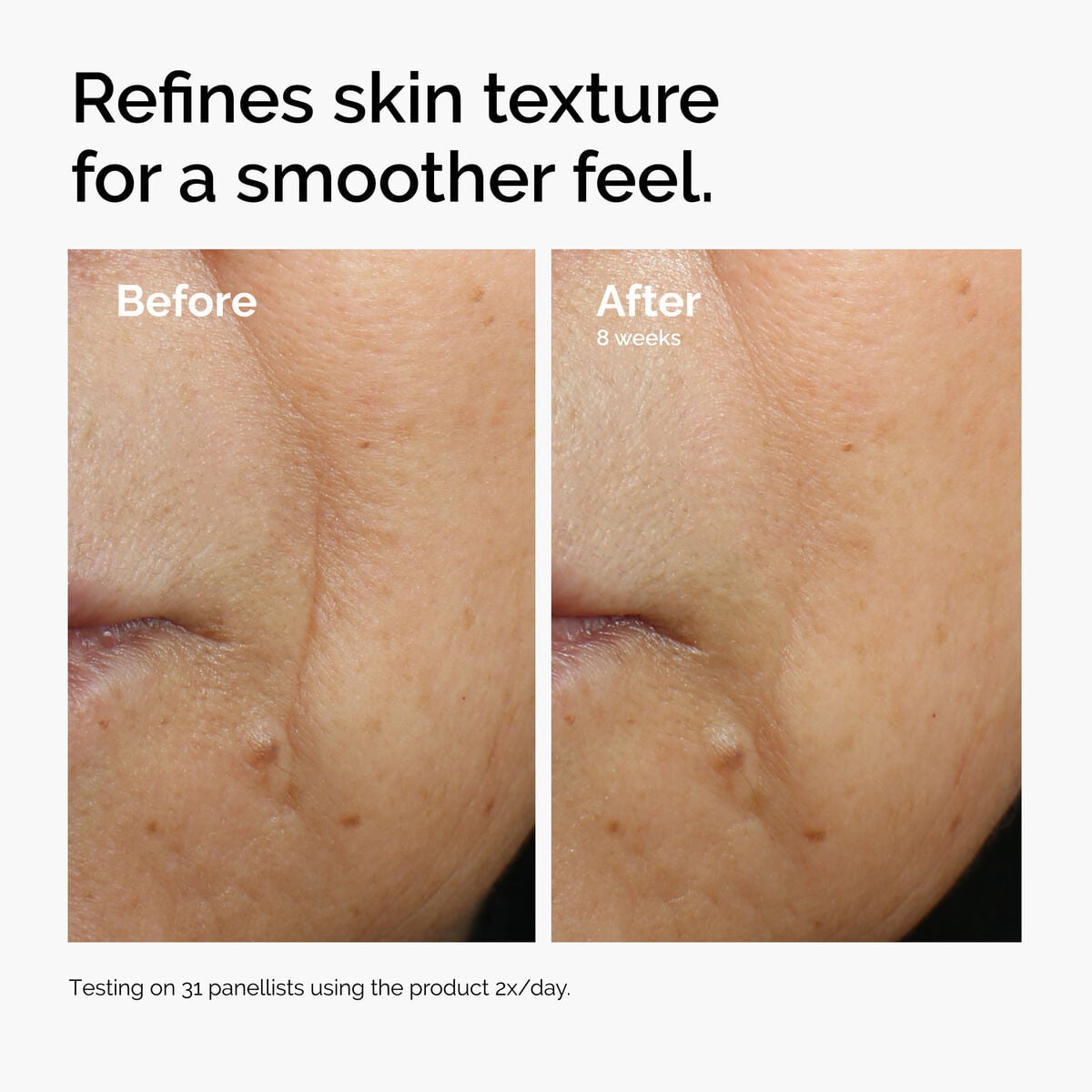 3% + Escin 1% Face Serum - Fresh Reset