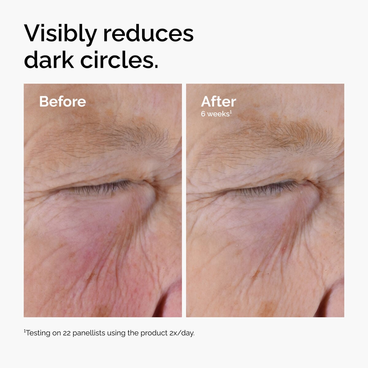 5% + EGCG Eye Serum - Daily Set