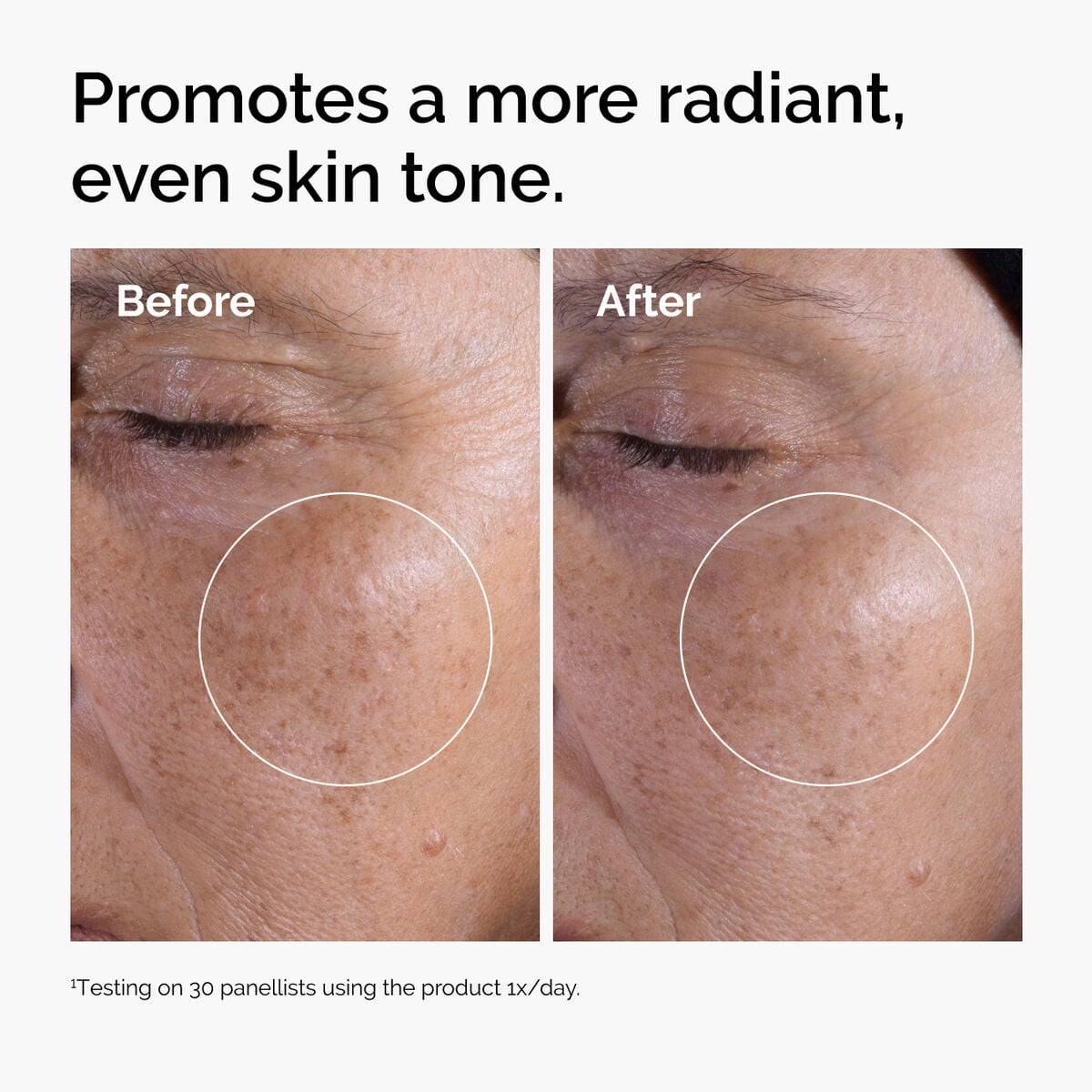 Acid 7% Exfoliating Toner - Daily Set