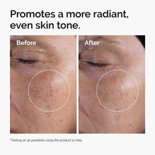 Acid 7% Exfoliating Toner - Simple Edit